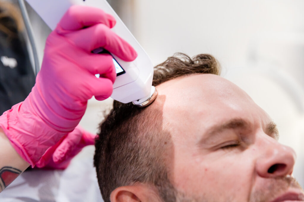 Professional wearing gloves treats patient for hair restoration in Oklahoma City